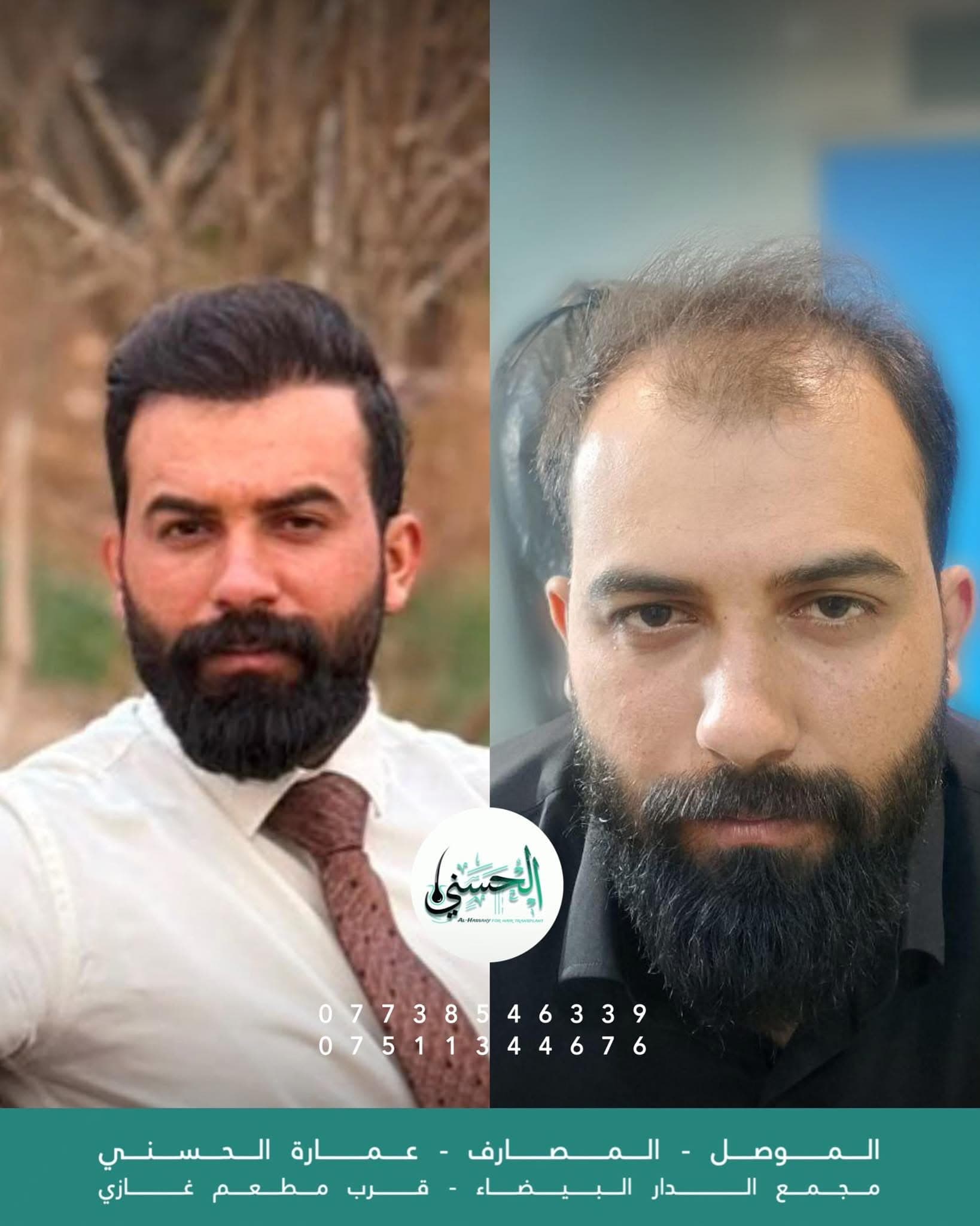 عن العيادة
